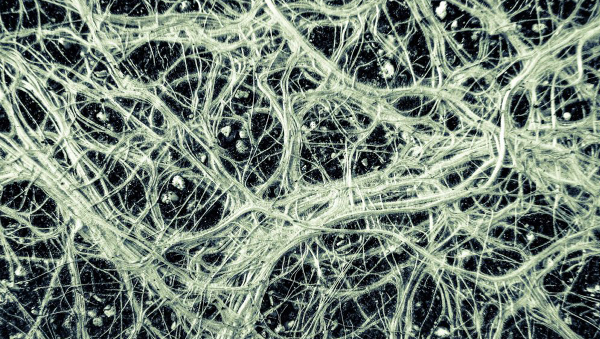 Plants and mycorrhizae: imo 2