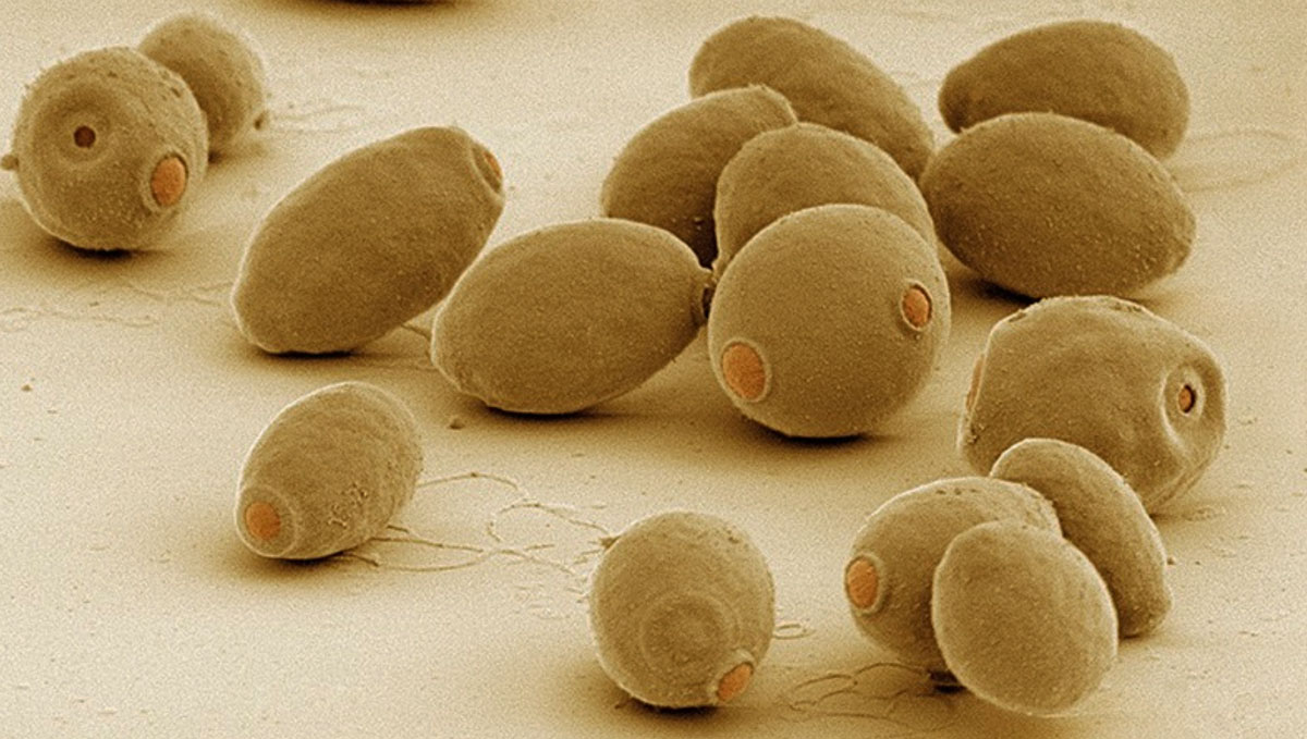 Brewing Plants With Hacked Beer Yeast: Scientists turn yeast into strength.