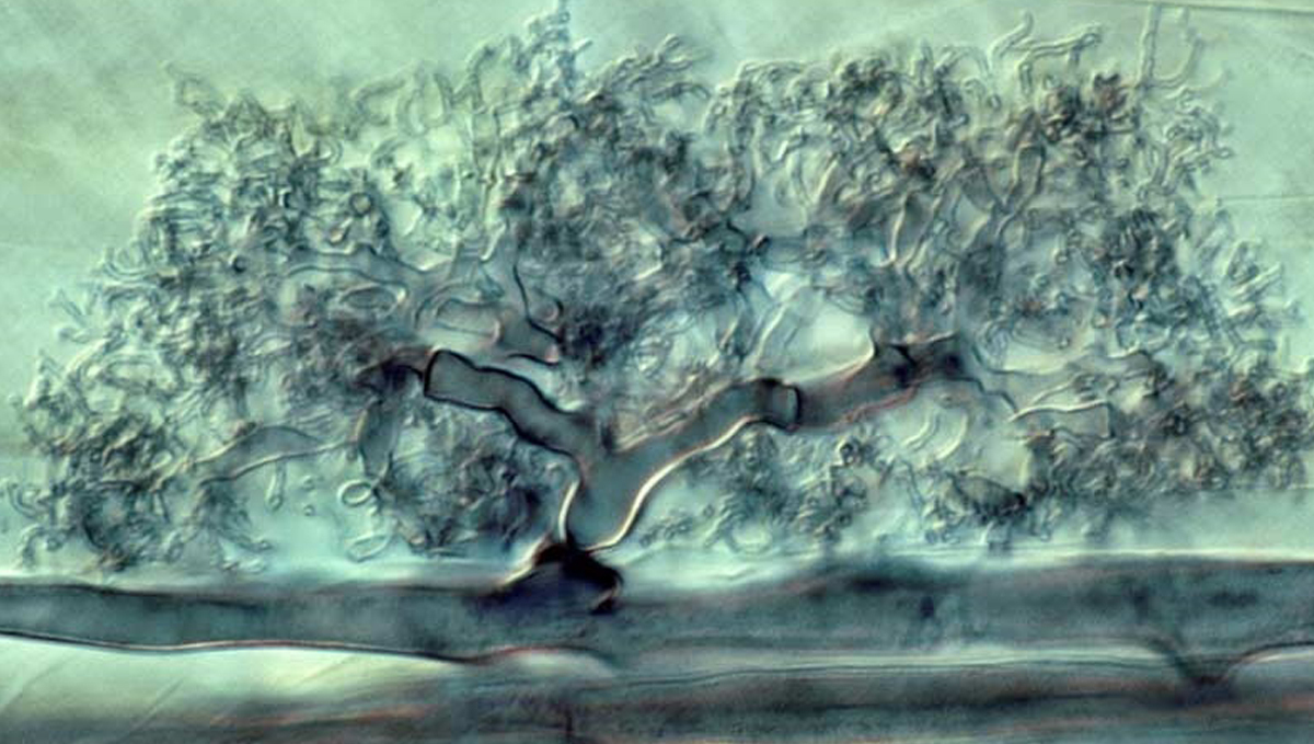 Plants and mycorrhizae: ericoid fungi