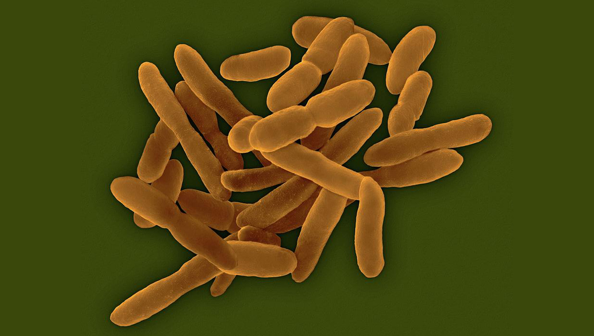 Benefits of microorganisms: anthrobacter