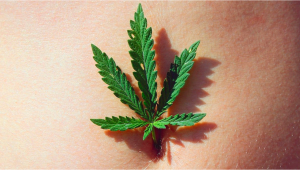 Plants-Hyperemesis-Syndrom / Plantsbedingte Magenbeschwerden