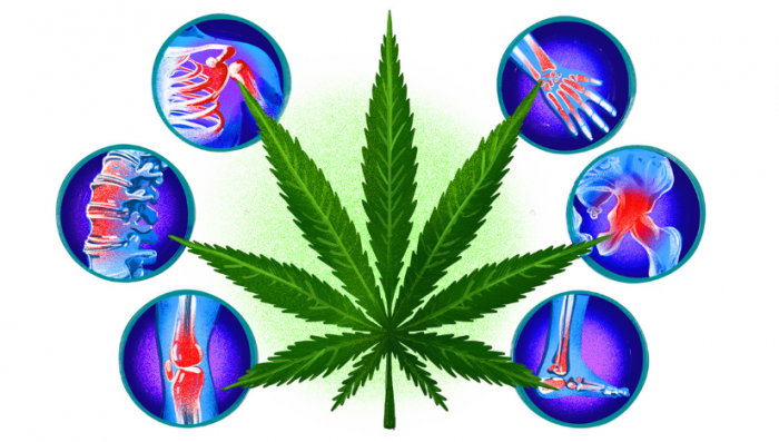 Can Medical Plants Relieve Chronic Pain?